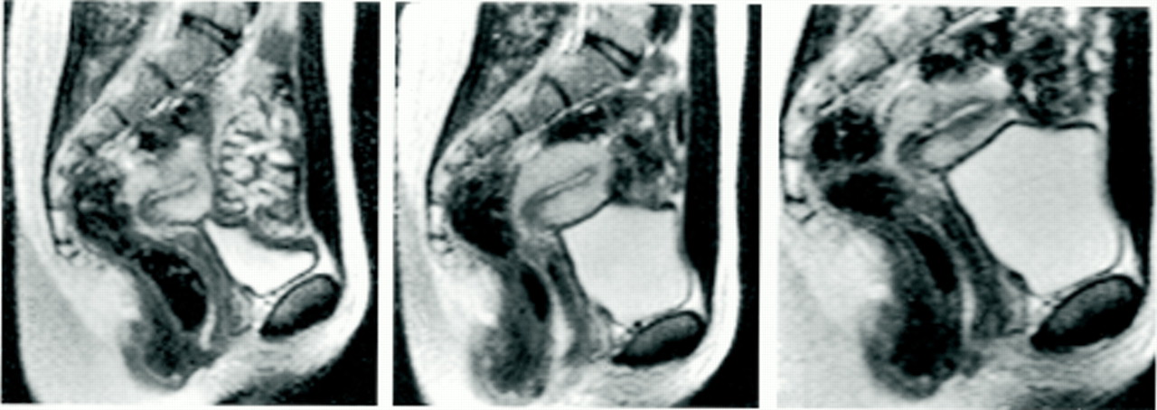 bmj mri
